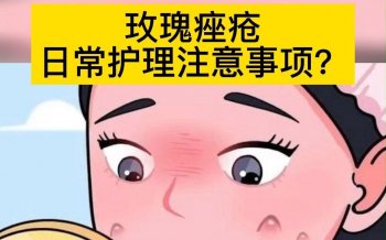 南京治玫瑰痤疮（酒渣鼻）去哪看